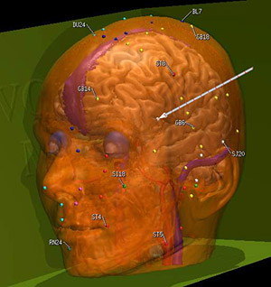 Fig. 2. Interactively explorable three-dimensional model