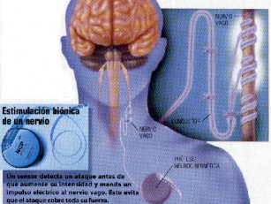 cssheader=[mhead1] header=[docs/imagenes/bioniccerebro.jpg] cssbody=[mbody1] body=[<br><em>01/01/1970 02:00</em>]